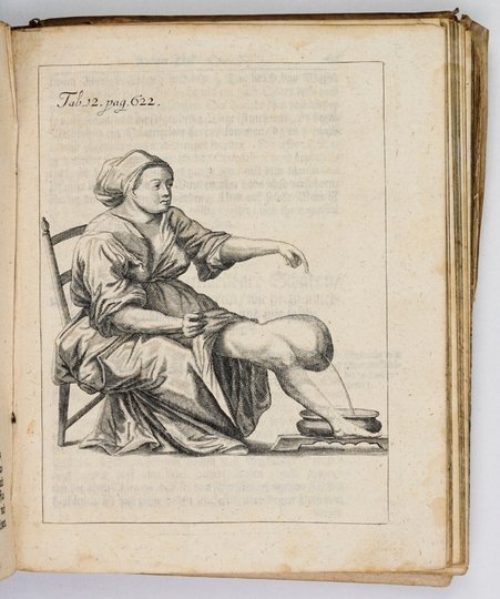 PURMANN Matthäus Gottfried - Matthæi Gothof. Purmanni, Chirurgi und Stadt-Artztes zu Bresslau, Herausgegebene Chirurgia Curiosa, darinnen ein jedweder Chirurgus nicht allein auffs gründlichste sehen und finden kan, was in die gantze Wund-Artzney vor künst