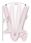 Vaginal Speculum