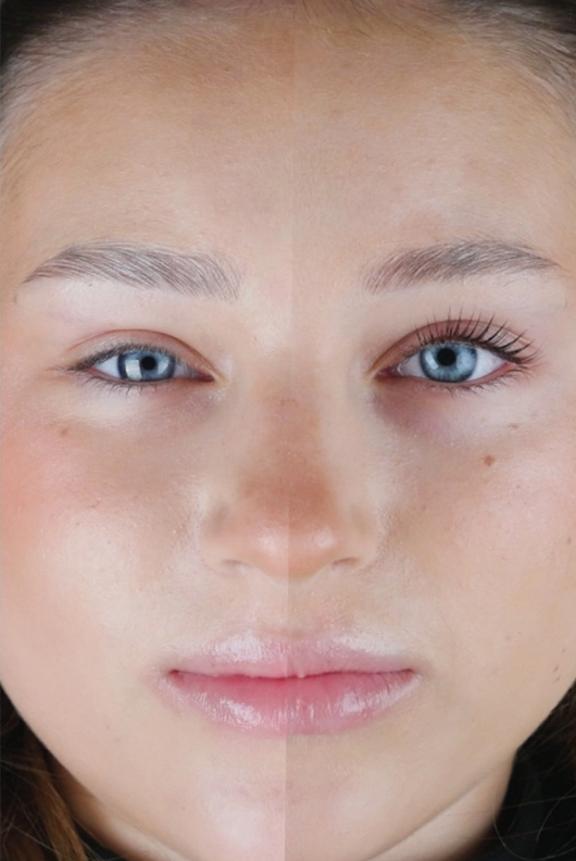 Rarity Lami Melt - Step 1 (5ml) 