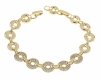 gold bracelet for a gold-plated leg