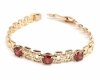 gold bracelet for a gold-plated leg