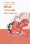 Atlas retinopatii cukrzycowej