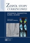 Zespół stopy cukrzycowej Patogeneza diagnostyka klinika leczenie