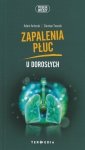Zapalenia płuc u dorosłych