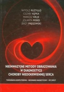 Nieinwazyjne metody obrazowania w diagnostyce choroby niedokrwie