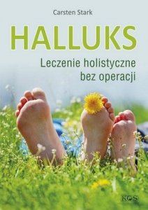 Halluks Leczenie holistyczne bez operacji