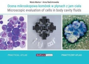 Ocena mikroskopowa komórek w płynach z jam ciała 