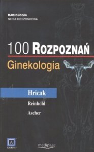 100 rozpoznań Ginekologia