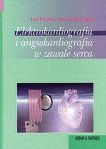 Elektrokardiografia i angiokardiografia w zawale serca