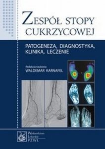 Zespół stopy cukrzycowej Patogeneza diagnostyka klinika leczenie