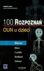 100 rozpoznań OUN u dzieci