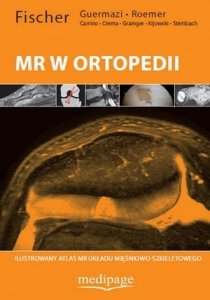 MR w ortopedii