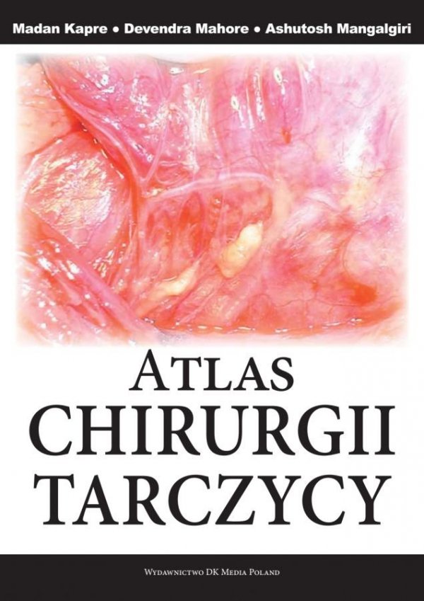 Atlas chirurgii tarczycy