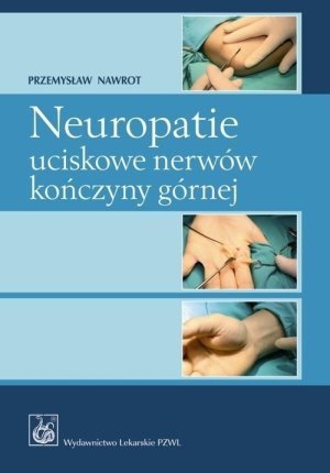 Neuropatie uciskowe nerwów kończyny górnej