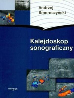 Kalejdoskop sonograficzny