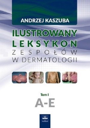 Ilustrowany leksykon zespołów w dermatologii Tom 1 A E