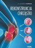 Rekonstrukcja chrząstki 