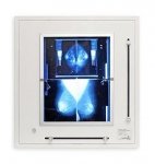 Negatoskop żaluzjowy do mammografii NGP 21 mZ