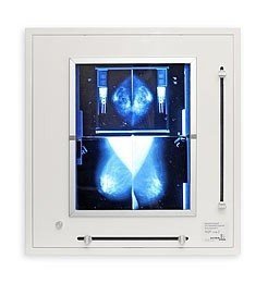 Negatoskop żaluzjowy do mammografii NGP 21 mZ