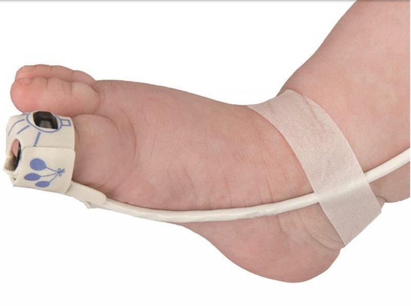 NONIN 8000J-Sensor Flex do pulsoksymetru niemowlęcego, z kablem 1m System czujników pulsoksymetrii wielokrotnego użytku