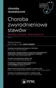 CHOROBA ZWYRODNIENIOWA STAWÓW. WSPÓŁCZESNE SPOJRZENIE