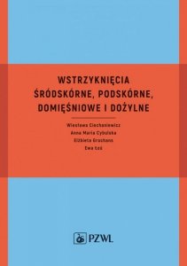 Wstrzyknięcia śródskórne, podskórne, domięśniowe i dożylne