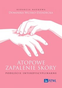 Atopowe zapalenie skóry. Podejście interdyscyplinarne