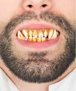 Sztuczne zęby - Troll