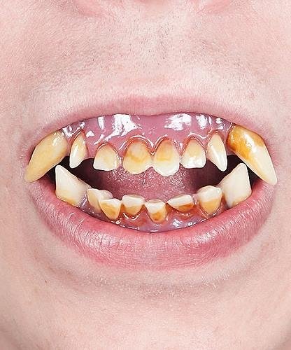 Sztuczne zęby - Bestia