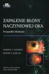 Zapalenie błony naczyniowej oka