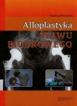 Alloplastyka stawu biodrowego