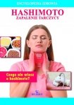 Encyklopedia zdrowia. Hashimoto-zapalenie