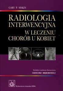 Radiologia interwencyjna w leczeniu chorób u kobiet