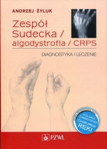 Zespół Sudecka / Algodystrofia / CRPS