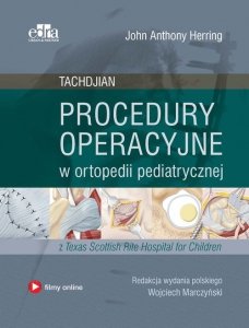 Procedury operacyjne w ortopedii pediatrycznej. Tachdjian