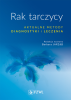 Rak tarczycy. Aktualne metody diagnostyki i leczenia 
