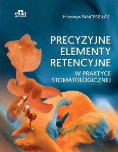 Precyzyjne elementy retencyjne w praktyce stomatologicznej