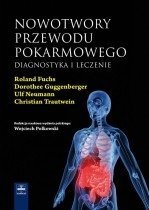 Nowotwory przewodu pokarmowego. Diagnostyka i leczenie