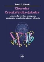 Choroba Creutzfeldta-Jakoba i inne choroby wywołane przez priony – pasażowalne encefalopatie gąbczaste człowieka