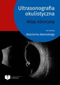 Ultrasonografia okulistyczna. Atlas kliniczny