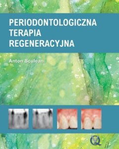 Periodontologiczna terapia regeneracyjna