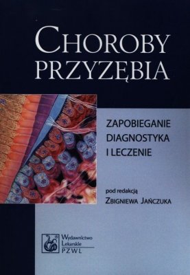 Choroby przyzębia