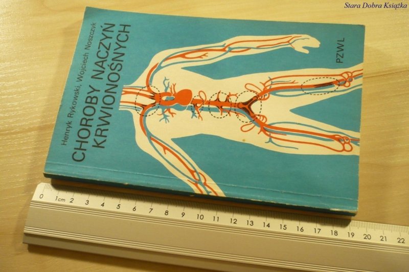 CHOROBY NACZYŃ KRWIONOŚNYCH - Rykowski (1980)