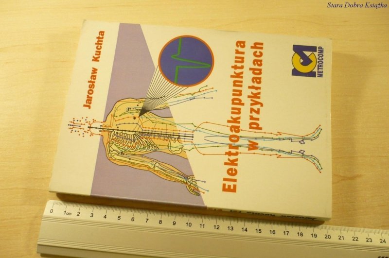 ELEKTROAKUPUNKTURA W PRZYKŁADACH - Kuchta (1993)
